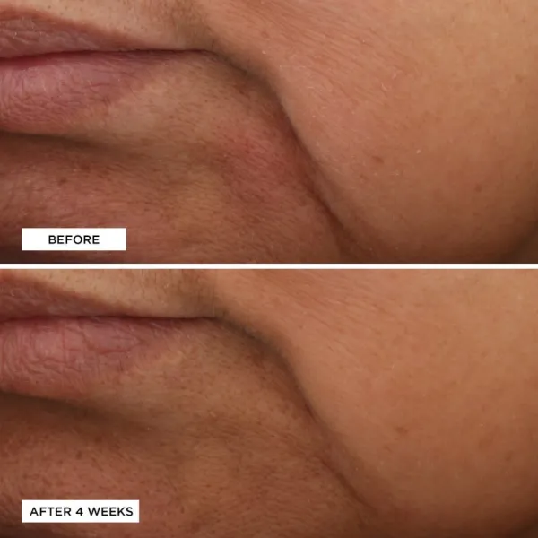 Perricone MD Essential Fx Acyl-Glutathione Moisturizer omladzujúci hydratačný krém proti vráskam 30 ml