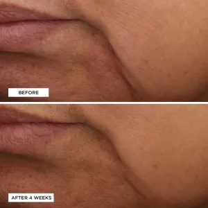 Perricone MD Essential Fx Acyl-Glutathione Moisturizer omladzujúci hydratačný krém proti vráskam 30 ml