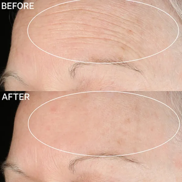 StriVectin Anti-Wrinkle SD Advanced Plus koncentrovaný krém redukujúci vrásky 118 ml