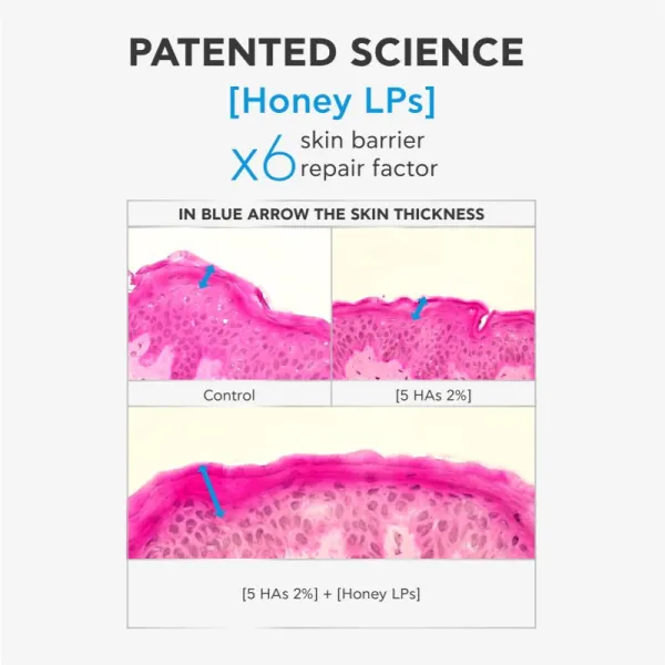 Apivita Bee Tech Concentrates HA5 Honey Repair Serum revitalizačné sérum s kyselinou hyalurónovou 30 ml