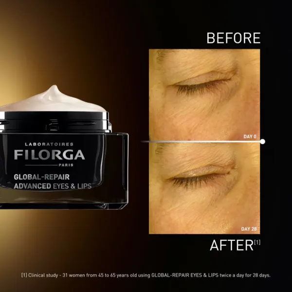 FILORGA GLOBAL-REPAIR ADVANCED EYES & LIPS krém proti vráskam na kontúrovanie očí a pier 15 ml