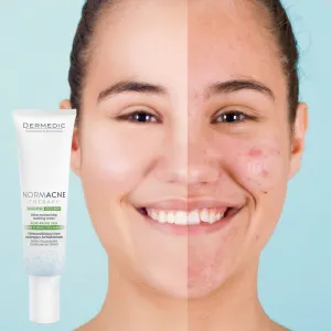 Dermedic Normacne Therapy hydratačný krém na aknóznu pleť 40 ml