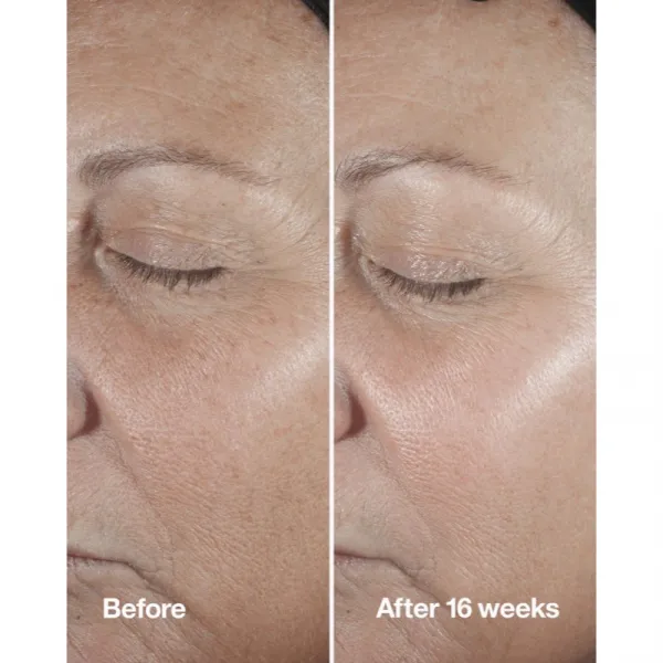 Clinique Smart Clinical™ Repair Wrinke Correcting Serum pleťové sérum na korekciu vrások 50 ml