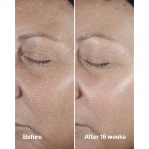 Clinique Smart Clinical™ Repair Wrinke Correcting Serum pleťové sérum na korekciu vrások 50 ml