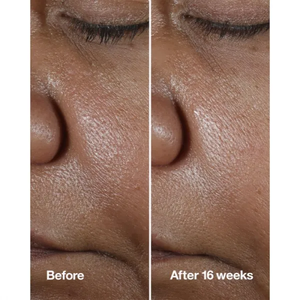 Clinique Smart Clinical™ Repair Wrinke Correcting Serum pleťové sérum na korekciu vrások 50 ml