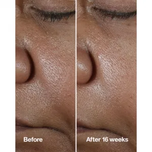 Clinique Smart Clinical™ Repair Wrinke Correcting Serum pleťové sérum na korekciu vrások 50 ml