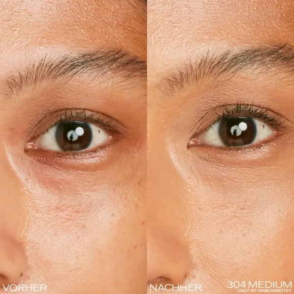 Shiseido Synchro Skin Radiant Lifting Concealer rozjasňujúci korektor odtieň Medium 304 2.7 g