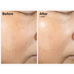 The Ordinary Rice Lipids + Ectoin Microemulsion ľahká hydratačná emulzia na upokojenie pleti 60 ml